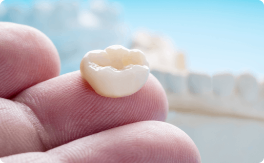 Dental crown