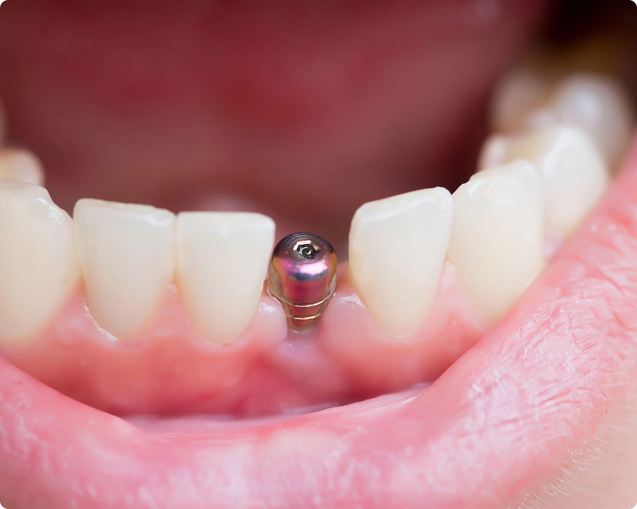 Dental implant clinic