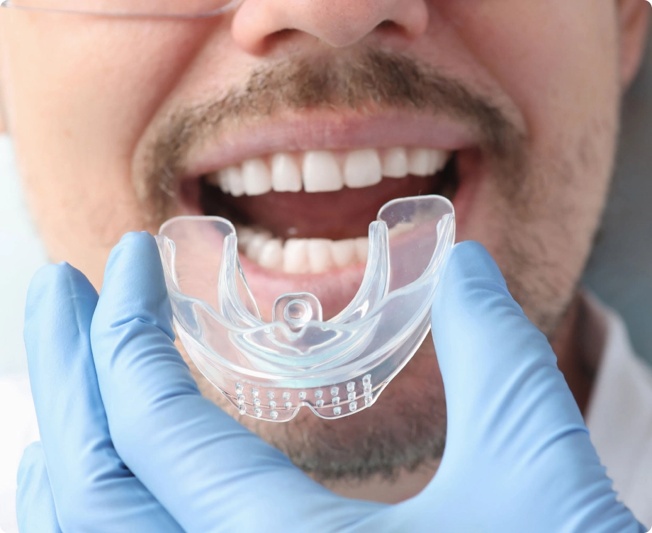Man wearing mouthguard