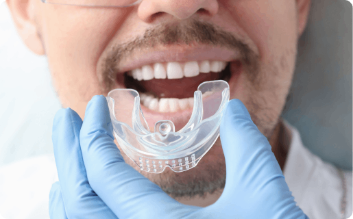 Mouthguard treatment