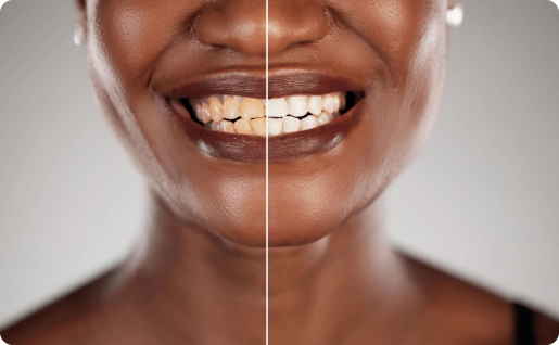 Woman smiling before after